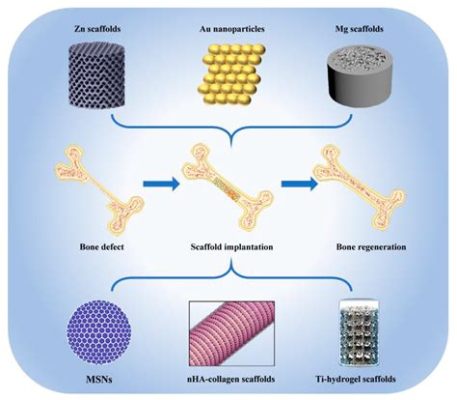 Keratin: Ein Biomaterial für Innovative Implantate und Geweberegeneration!